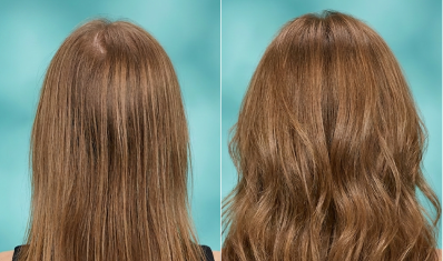 Before and after