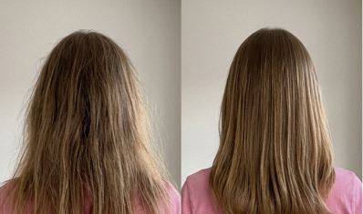 Before and after