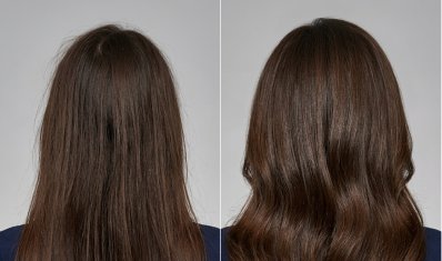 Before and after