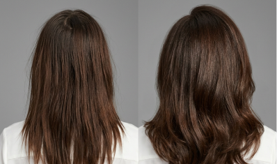 Before and after